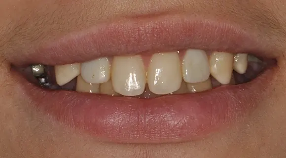 Case 5, before: yellowed.